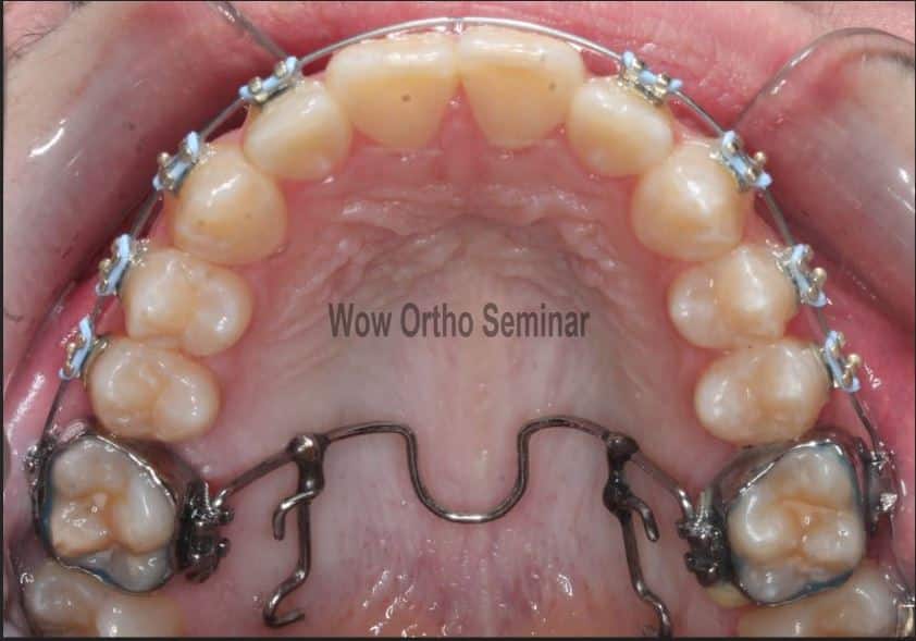 wow orthodontic seminar