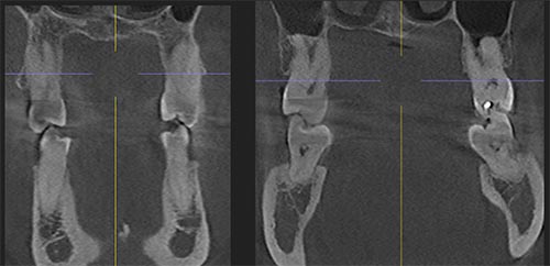 cone beam CT orthodontics