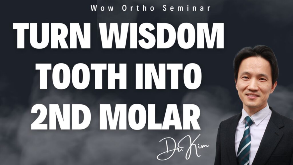 Replacing 2nd molar with wisdom tooth