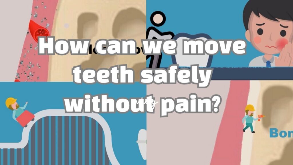 How can teeth move